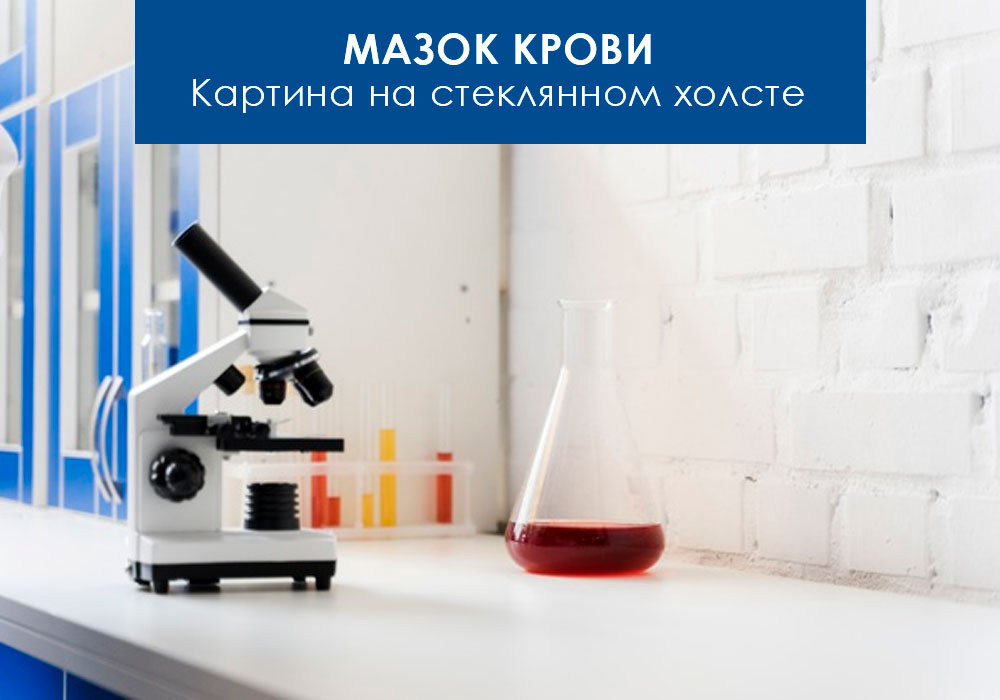 Мазок крови. Картина на стеклянном холсте